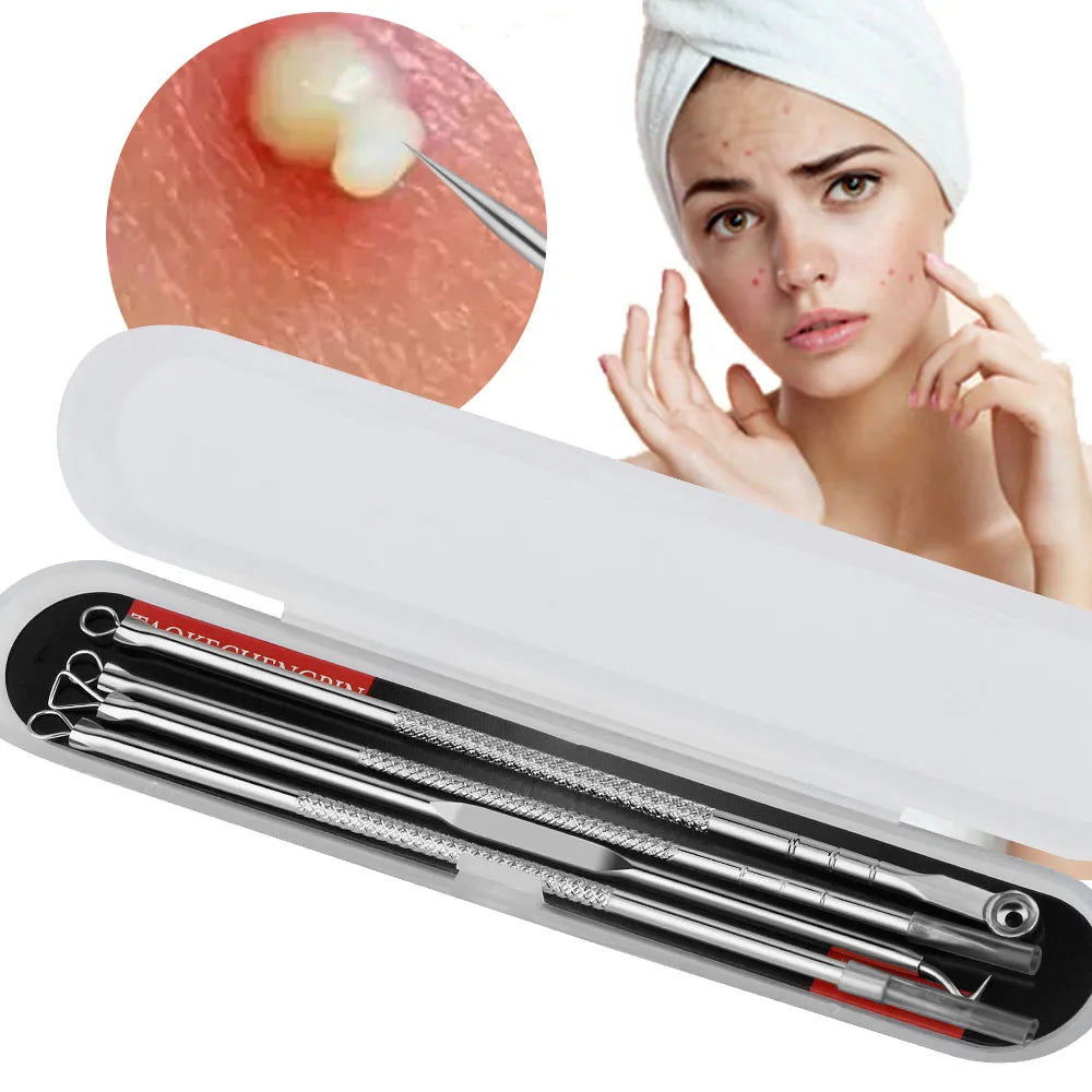 Set of 4 Anti-Blackhead and Acne Tools
