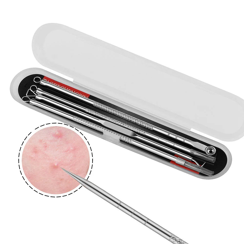 Set of 4 Anti-Blackhead and Acne Tools